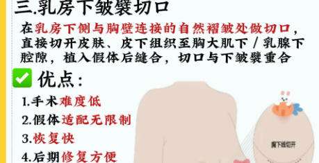 何金光隆胸怎么样?附术后注意事项详解!速速来看插图4 何金光隆胸怎么样?附术后注意事项详解!速速来看插图4
