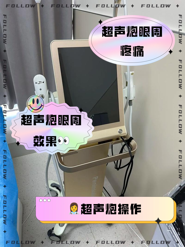 北京超声炮眼周价格多少钱？北京地区超声炮眼周护理的具体费用插图1
