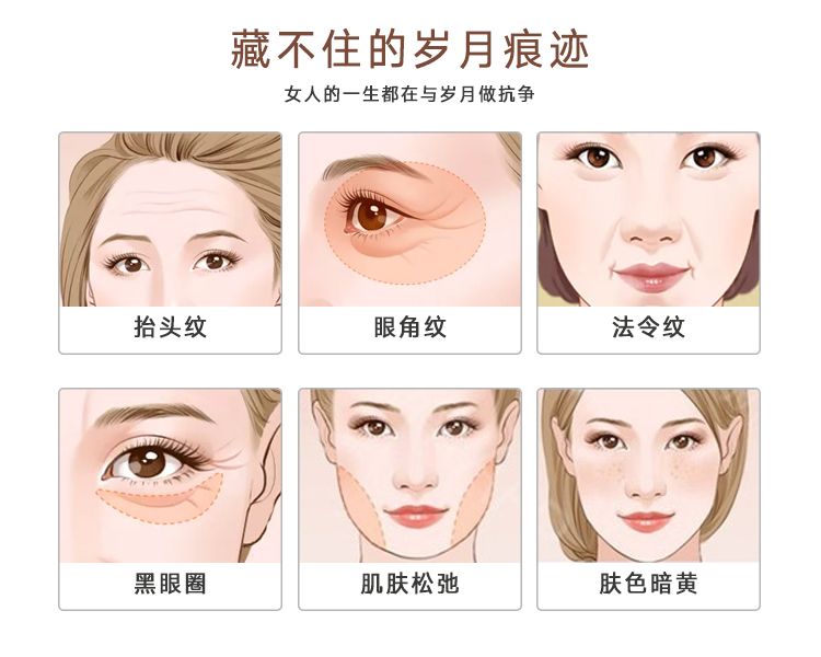 北京热玛吉眼周价格多少钱？热玛吉眼周治疗费用及效果插图2