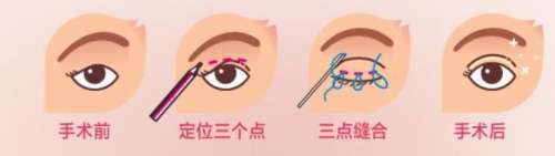 葫芦岛颐正整形价格表揭晓|医院真实的顾客评价来袭插图4 葫芦岛颐正整形价格表揭晓|医院真实的顾客评价来袭插图4