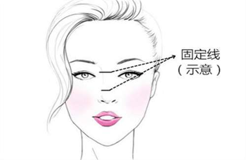 硅胶隆鼻多少钱?硅胶隆鼻多久能恢复?点击了解插图1 硅胶隆鼻多少钱?硅胶隆鼻多久能恢复?点击了解插图1