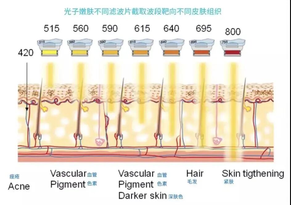 AOPT超光子与DPL光子嫩肤到底有啥不同？选错不仅白花钱还伤肤插图1
