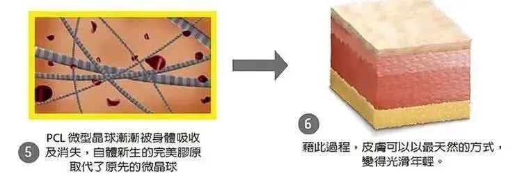 少女针和童颜针哪个好?看完这篇文章你就明白插图2 少女针和童颜针哪个好?看完这篇文章你就明白插图2