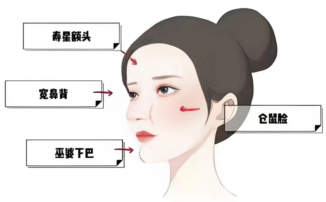 深圳地区专业医院进行馒化脸修复手术的具体费用是多少?插图1 深圳地区专业医院进行馒化脸修复手术的具体费用是多少?插图1