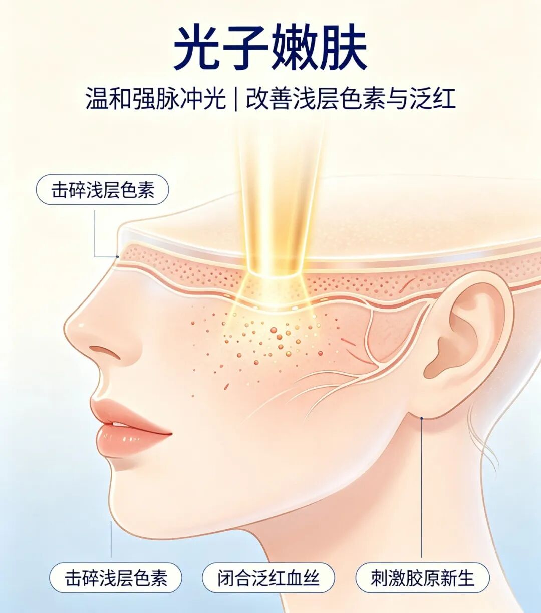 北京光子嫩肤预约指南 | 在北京如何预约靠谱的的光子嫩肤医院插图1 北京光子嫩肤预约指南 | 在北京如何预约靠谱的的光子嫩肤医院插图1