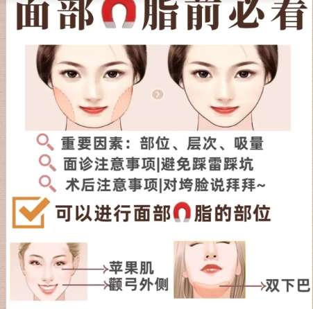 曹飞超医生口碑怎么样?脂肪整形熙禾医疗美容旗舰店插图1 曹飞超医生口碑怎么样?脂肪整形熙禾医疗美容旗舰店插图1