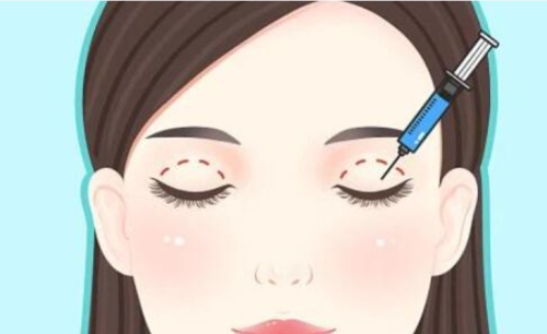 医学科学院整形外科医院割双眼皮挂什么科?科室选择和挂号攻略插图 医学科学院整形外科医院割双眼皮挂什么科?科室选择和挂号攻略插图