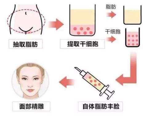 芜湖壹加壹医疗美容医院自体脂肪填充太阳穴|医生推荐与真实案例插图2