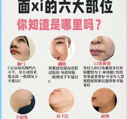 曹飞超医生口碑怎么样?脂肪整形熙禾医疗美容旗舰店插图2 曹飞超医生口碑怎么样?脂肪整形熙禾医疗美容旗舰店插图2