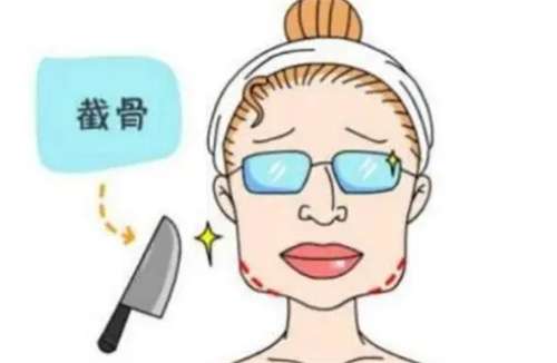 长沙磨骨手术价格？一并了解四名口碑医生插图