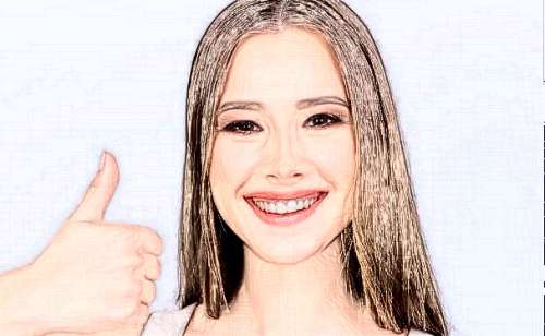 吉林大学第一医院二部鼻唇沟填充术后6个月案例|技术能力怎么样?医生介绍插图2 吉林大学第一医院二部鼻唇沟填充术后6个月案例|技术能力怎么样?医生介绍插图2