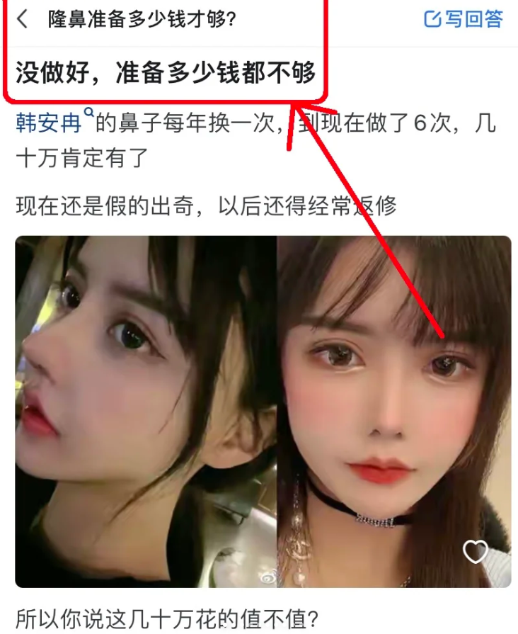 广州隆鼻修复多少钱?隆鼻修复价格及注意事项插图2 广州隆鼻修复多少钱?隆鼻修复价格及注意事项插图2