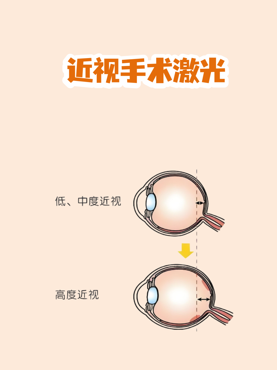 深圳眼修复手术预约指南 | 深圳专业的眼部整形修复手术插图1 深圳眼修复手术预约指南 | 深圳专业的眼部整形修复手术插图1