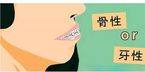 正颌一般多少钱?正颌年龄介绍,术前解析插图2 正颌一般多少钱?正颌年龄介绍,术前解析插图2