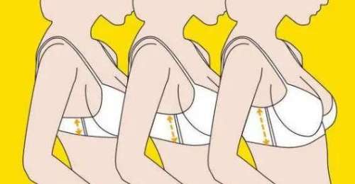 郑州隆胸费用多少钱？做隆胸手术后如何护理插图
