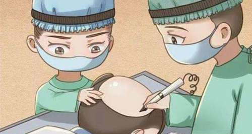 调整发际线价格插图1 调整发际线价格插图1