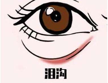 重庆泪沟填充玻尿酸多少钱插图