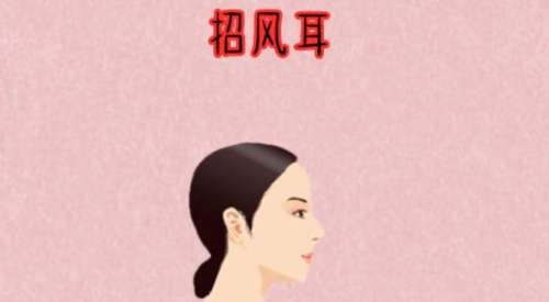 上海艺星整形医院做一只招风耳手术费用高吗?院内坐诊医生及案例分享插图4 上海艺星整形医院做一只招风耳手术费用高吗?院内坐诊医生及案例分享插图4