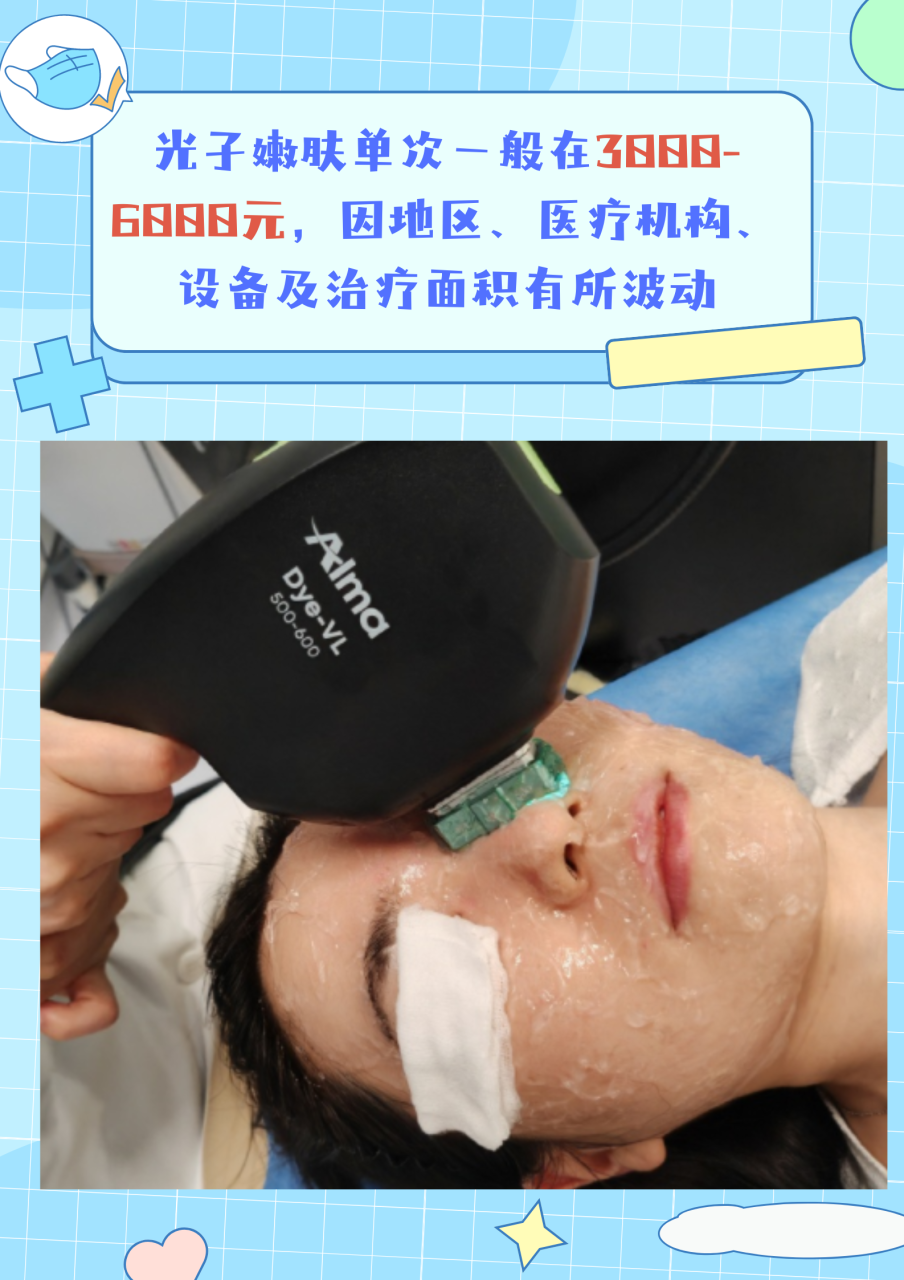 上海做超光子嫩肤多少钱一次?插图1 上海做超光子嫩肤多少钱一次?插图1