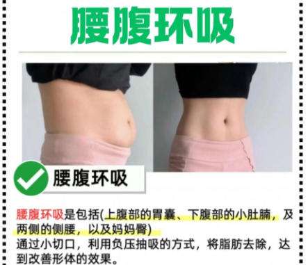 黄杰医生口碑怎么样?脂肪整形北京嘉禾插图2 黄杰医生口碑怎么样?脂肪整形北京嘉禾插图2