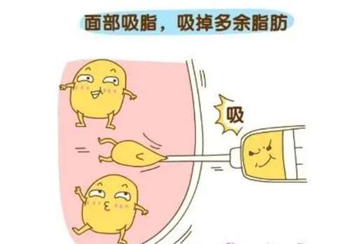局部抽脂手术价格分析表!收费明细查看插图2 局部抽脂手术价格分析表!收费明细查看插图2