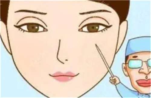 全切双眼皮多少钱啊?详细整形清单明细插图2 全切双眼皮多少钱啊?详细整形清单明细插图2