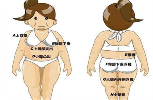 大腿吸脂多少钱啊?价格解析来袭,看技术优势插图1 大腿吸脂多少钱啊?价格解析来袭,看技术优势插图1