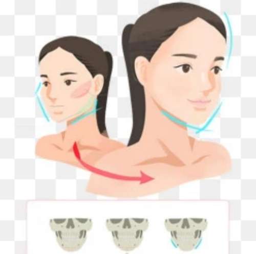 下颌角磨骨手术的费用大概是多少？一般在20000~50000元插图
