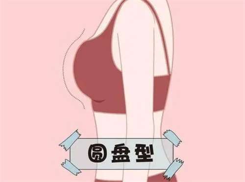 上海隆胸多少钱?费用明细与手术选择全面指南插图3 上海隆胸多少钱?费用明细与手术选择全面指南插图3