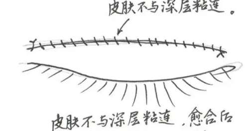王睿恒医生双眼皮案例图曝光!双眼皮实拍!妈生自然款让人心动插图1 王睿恒医生双眼皮案例图曝光!双眼皮实拍!妈生自然款让人心动插图1