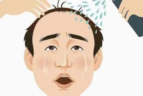 碧莲盛植发价格一览表公布!特色项目介绍!来看详细介绍插图3 碧莲盛植发价格一览表公布!特色项目介绍!来看详细介绍插图3