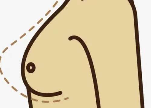 济南假体丰胸手术需多少钱?做隆胸手术后会留疤吗?插图1 济南假体丰胸手术需多少钱?做隆胸手术后会留疤吗?插图1