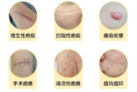 刘晓军医生口碑怎么样?瘢痕修复-南方医科大学南方医院插图1 刘晓军医生口碑怎么样?瘢痕修复-南方医科大学南方医院插图1