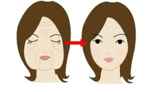 合肥拉皮除皱多少钱?在线看手术收费价格表插图 合肥拉皮除皱多少钱?在线看手术收费价格表插图