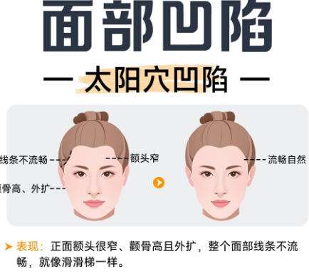 赵宏伟医生口碑怎么样?脂肪整形欧扬医疗美容插图4 赵宏伟医生口碑怎么样?脂肪整形欧扬医疗美容插图4
