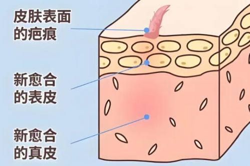 上海第八人民医院去疤痕多少钱?去疤痕真实花费曝光,到底靠谱吗?插图 上海第八人民医院去疤痕多少钱?去疤痕真实花费曝光,到底靠谱吗?插图