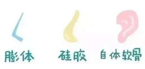 自体软骨鼻整形价格多少?价格通常18000元至79800元插图 自体软骨鼻整形价格多少?价格通常18000元至79800元插图