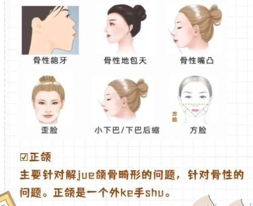 山东省立医院正颌手术怎么样?手术价格明细表更新插图2 山东省立医院正颌手术怎么样?手术价格明细表更新插图2