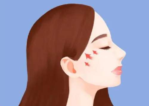 宽颧骨磨骨整形多少钱？手术有风险吗？术后多久恢复插图2
