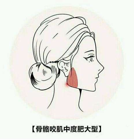 颧骨内推加下颌角一共多少钱插图1 颧骨内推加下颌角一共多少钱插图1