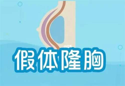 假体隆胸价格贵吗?收费价格表分析插图1 假体隆胸价格贵吗?收费价格表分析插图1