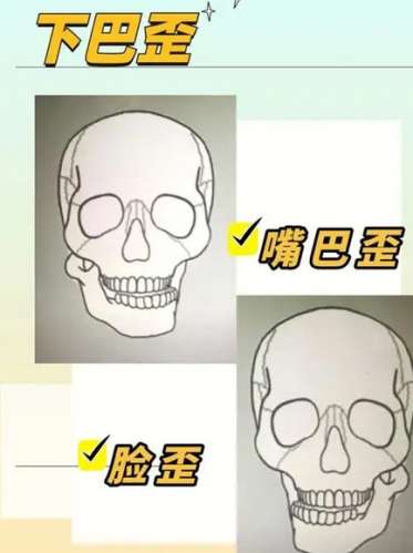嘴巴歪整形大概多少钱插图 嘴巴歪整形大概多少钱插图
