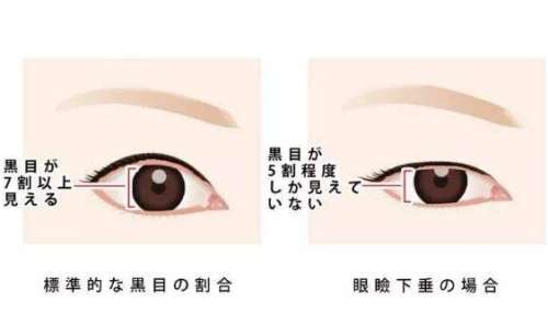 上海时光整形外科医院双眼皮整形口碑排名|真实案例+医生详情插图2 上海时光整形外科医院双眼皮整形口碑排名|真实案例+医生详情插图2