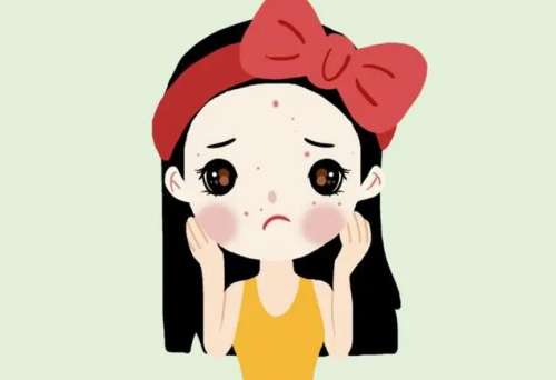 激光祛痘怎么收费插图 激光祛痘怎么收费插图