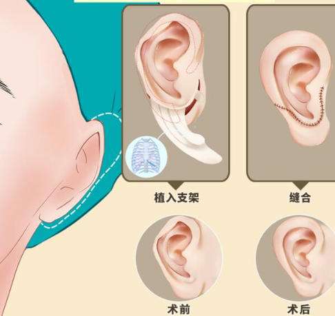 赵延勇做耳再造吗?附医院介绍及客户口碑点评插图1 赵延勇做耳再造吗?附医院介绍及客户口碑点评插图1