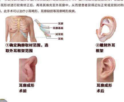 赵延勇做耳再造吗?附医院介绍及客户口碑点评插图3 赵延勇做耳再造吗?附医院介绍及客户口碑点评插图3