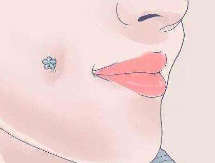 常州爱芙莱玻尿酸多少钱插图