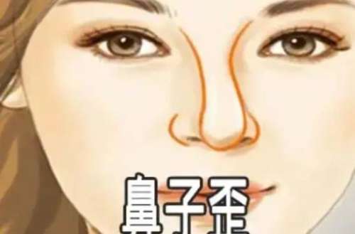 上海第九人民医院歪鼻畸形矫正多少钱?医院技术优势及经典案例图曝光!插图2 上海第九人民医院歪鼻畸形矫正多少钱?医院技术优势及经典案例图曝光!插图2