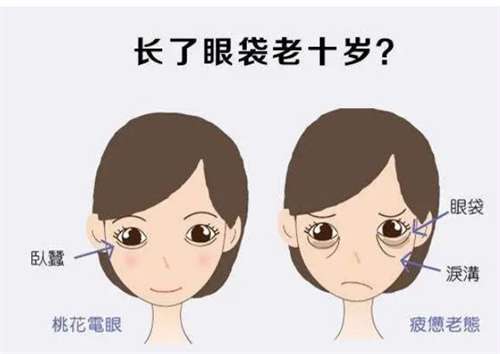 广州手术祛眼袋多少钱？在线看口碑好的医院插图1
