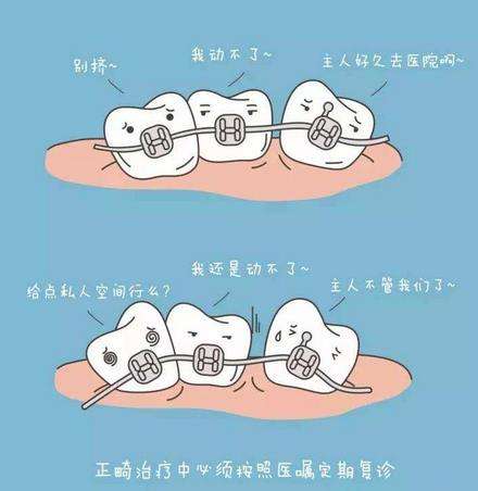 地包天矫正一般费用是多少？插图1